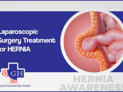 Laparoscopic Surgery Treatment for Hernia