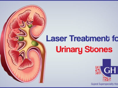 Laser Treatment for Urinary Stones