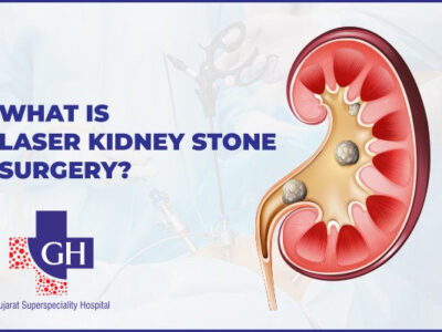 What Is Laser Kidney Stone Surgery?