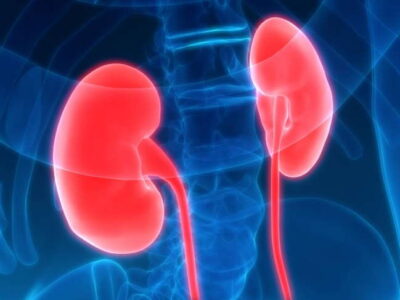 Chronic Kidney Disease