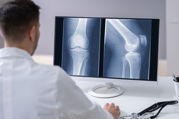Medical Conditions that Require a Knee Replacement Surgery
